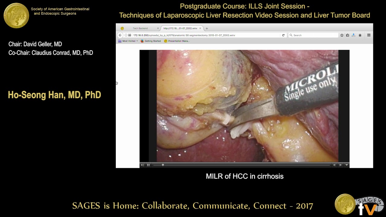 Evidence-Based Treatment Selection and Sequencing in Advanced HCC