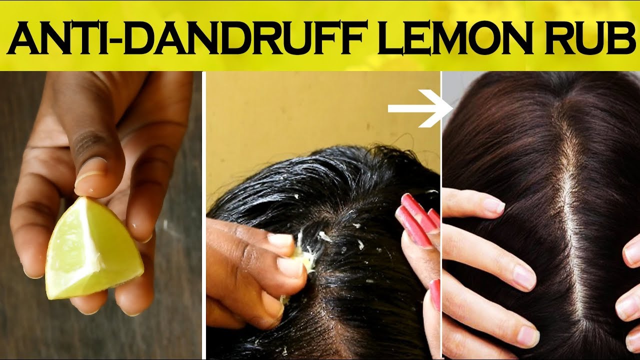 How to Use Lemon Juice to Rinse and Lighten Hair and Treat Dandruff   Bellatory