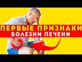 Первые Признаки Болезни Печени!