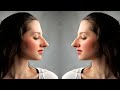 Cosmetic Gyn State of the Art 2022