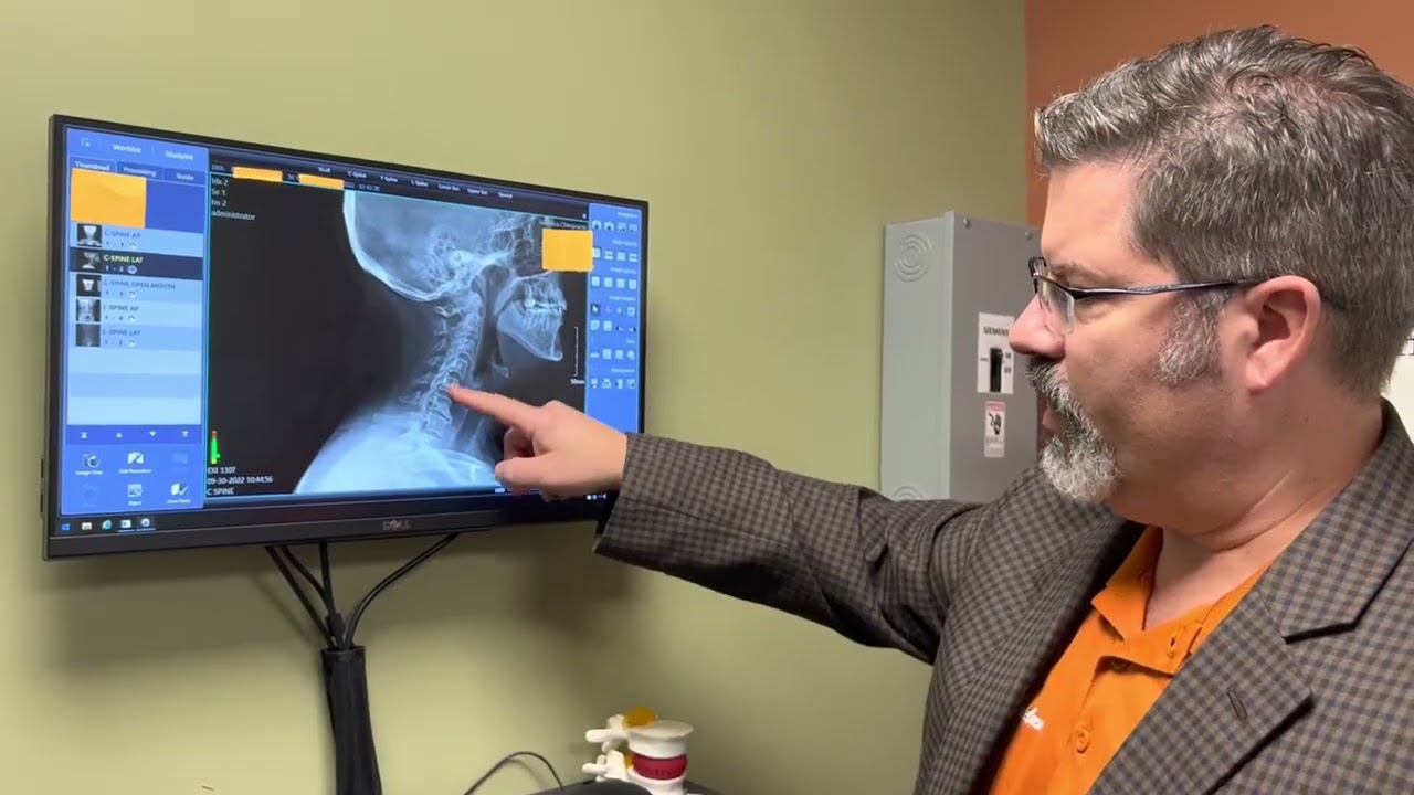 Text Neck: How Your Smartphone Is Causing Neck Pain -And What to Do About It