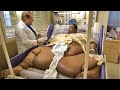 10 लोग जो मोटापे का शिकार हो गए , Top 10 Fattest People