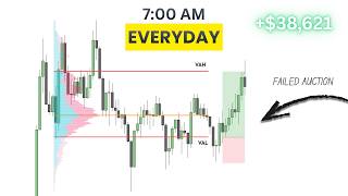 The Easiest Gold Volume Profile Trading Strategy That Works!