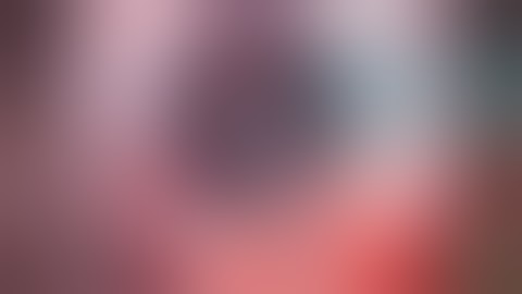 Malyugin Ring 2.0 for Small Pupil Cataract Surgery