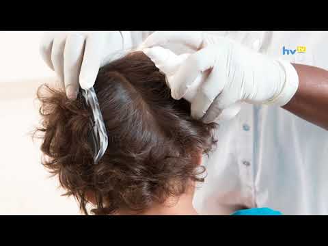 Videó: 3 módja annak, hogy megszabaduljunk az arcon lévő hajszálerektől