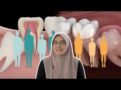 Video: Adakah gigi geraham enam tahun gugur?