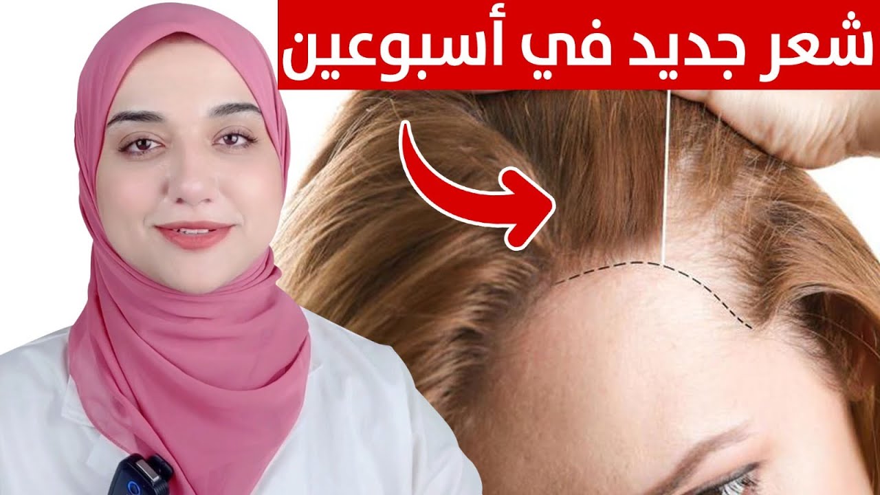 فراغات الشعر/ علاج نهائي بدون تضييع فلوس ع الفاضي