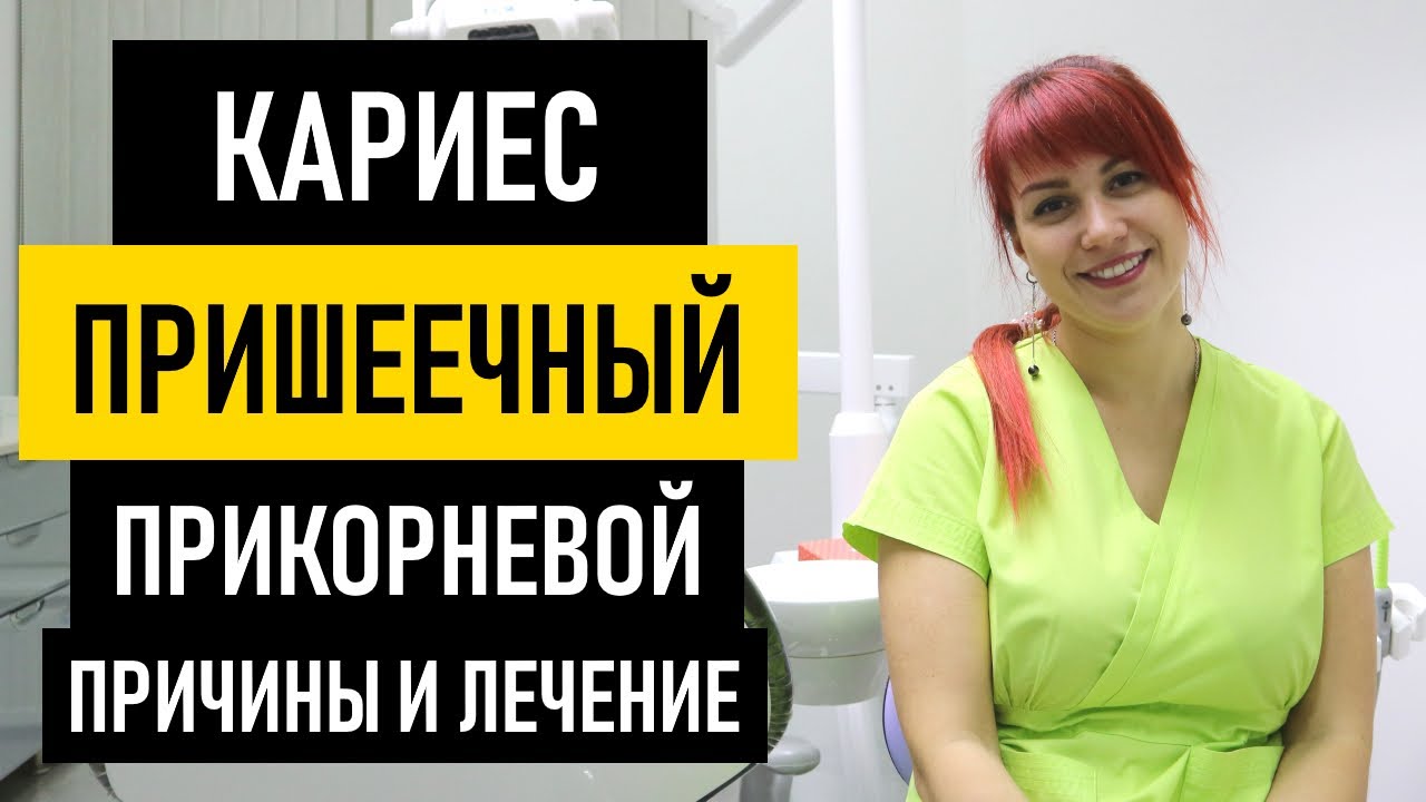 Прикорневой кариес: причины и лечение. Что делать и как предотвратить кариес
