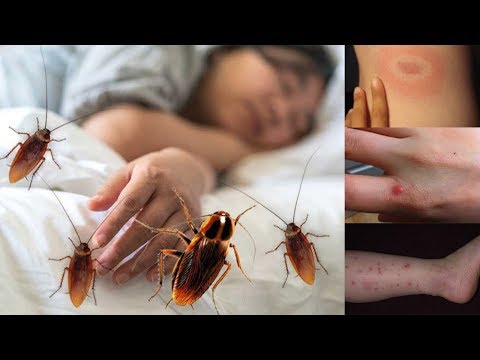 Video: Do home cockroaches bite?