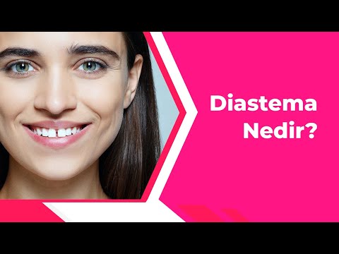 Video: Biologiyada diastema nədir?