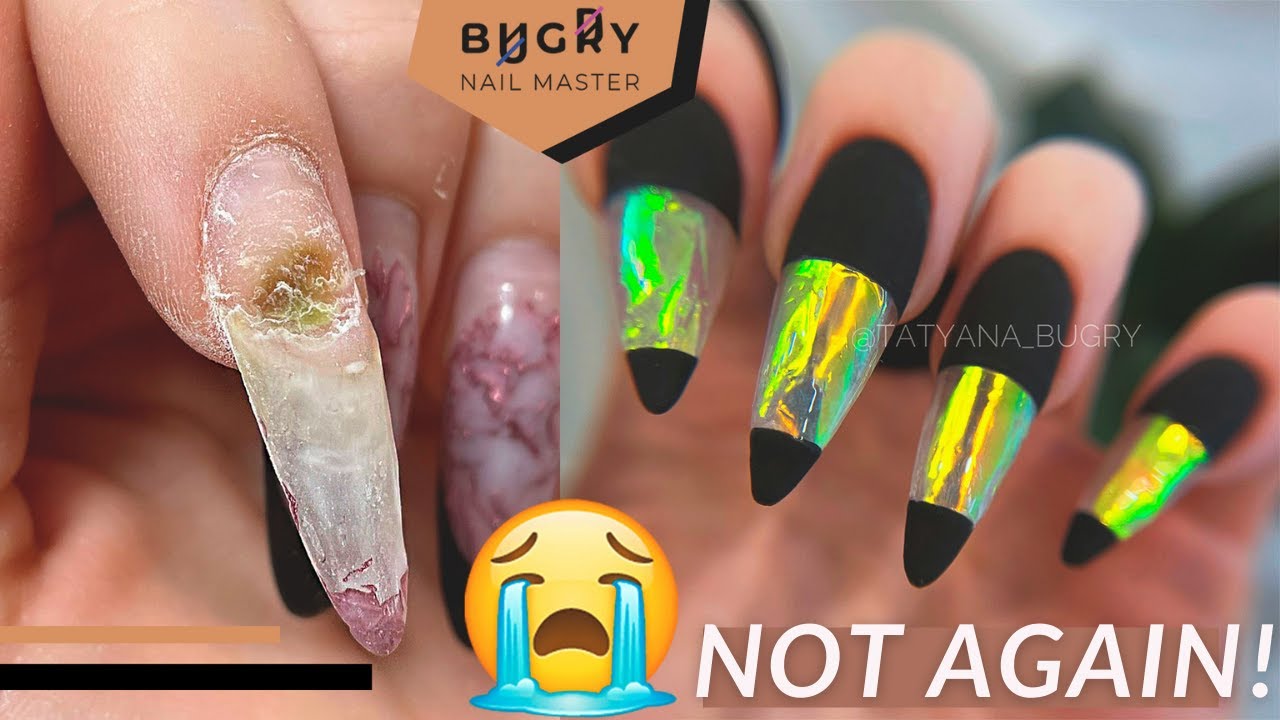 Does nail polish cause nail fungus? | Rainbow Nails' Blog