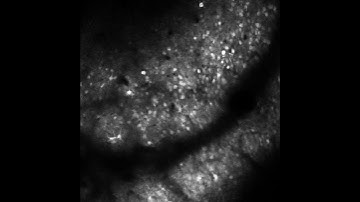 Visualizing Neuronal Activity Through a Cranial Window (2-photon microscopy)