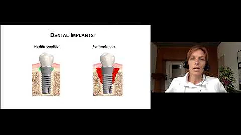 Dental Complications in EDS - Dr. Ines Kapferer-Se...