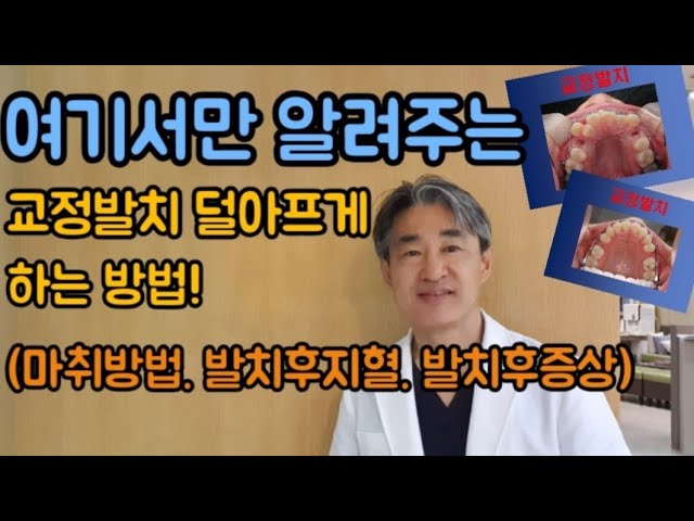 🎈교정발치의 모든것! (덧니, 돌출입 발치교정에서 마취/발치/지혈)
