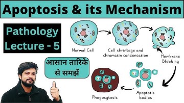 Apoptosis - Programmed Cell Death | Mechanism - Intrinsic  & Extrinsic Pathway | Pathology Lecture