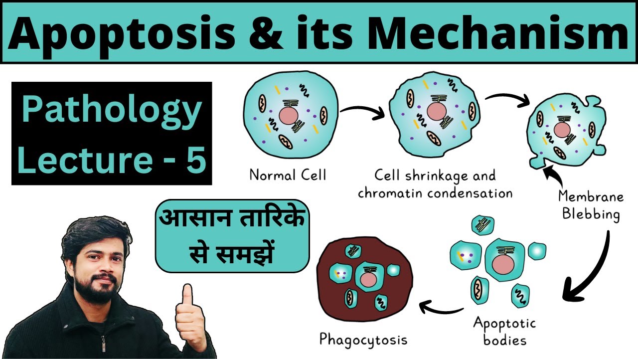 Apoptosis - Programmed Cell Death | Mechanism - Intrinsic  & Extrinsic Pathway | Pathology Lecture