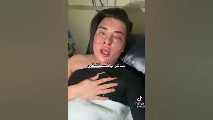 ساهر منذر بلمشفا قرر يرجع شب 😱😱#shorts #tiktok #