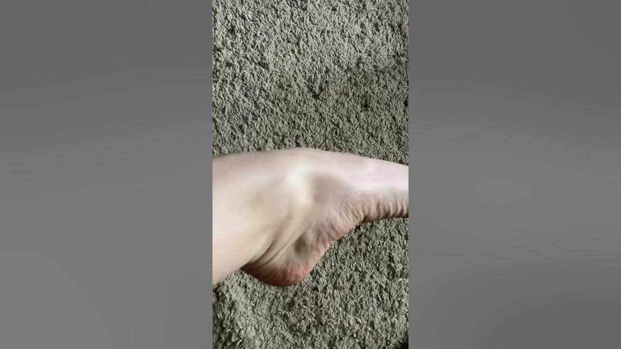 ankle-crunching-sound-why-several-months-after-sprain-youtube