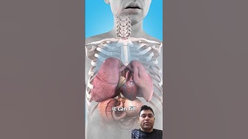 Collapsed Lung First Aid Life-Saving Steps You MUST Know | Education Films