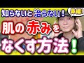 【肌の赤みをなくす方法】知らないと損！鼻の赤みの原因と治す方法とは！？