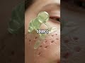 Most people try to fix acne by using random products #shorts#shortsfeed##health#ai#motivation