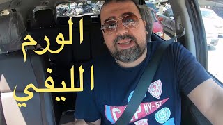 الورم الليفي| امتي لازم ينشال؟