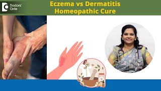 Eczema vs Dermatitis & Effective Complementary Homeopathic Treatment-Dr. Vindoo C |Doctors