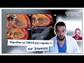 Tuto ENC Comment Planifier Un TMVR Par Sapien 3 mp3