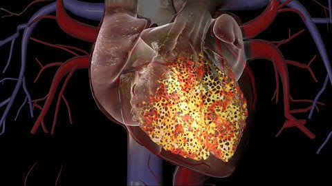Cardiac Conduction System
