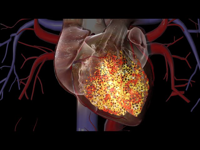 Cardiac Conduction System Animation