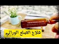 امبولات(hair mix ) لانبات الشعر وعلاج الصلع الوراثي