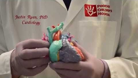 Infy Maker Awards Winner - 3D Printing of Congenital Heart Defect Models | 2017 Winners