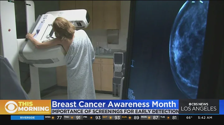 Susan G. Komen Foundation offering free mammograms...