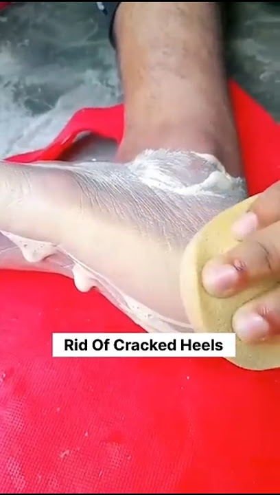 💯✅Repair Cracked At Home In 1 Day 🔥#Get Rid Of Cracked Heels#feetcare#heels#feet#ytshort#shortvideo