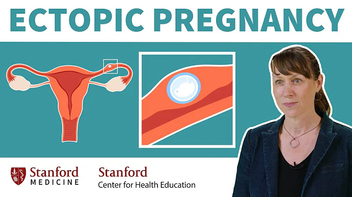 What is an ectopic pregnancy? Doctor explains risk factors, symptoms, & treatment | Stanford - DayDayNews