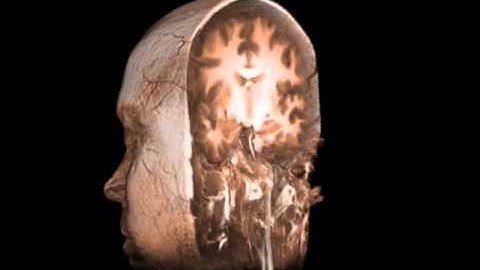 Magnetic Resonance Brain Imaging 3 - William Edward Hahn #shorts