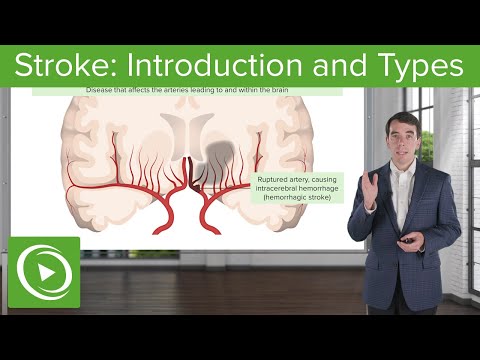 Stroke: Introduction and Types | Clinical Neurology