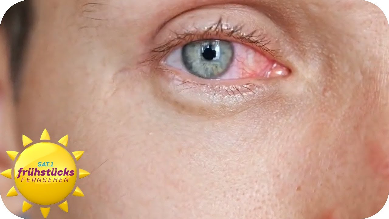 Trockene Schleimhäute Augen Nase Mund Wechseljahre www.youtube.com