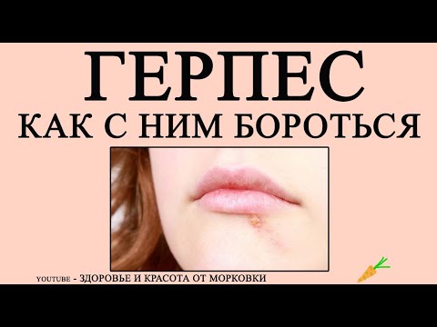 КАК ВЫЛЕЧИТЬ ГЕРПЕС НАРОДНЫМИ СРЕДСТВАМИ