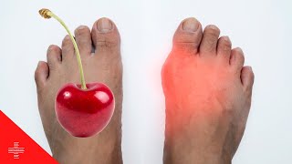 7 foods that can help LOWER URIC ACID LEVELS