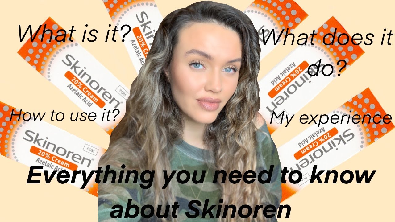 Skinoren - Everything you need to know about it! Including my personal experience with it!