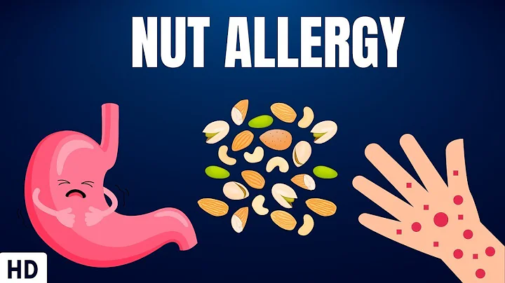 Nut Allergy: Everything You Need To Know - DayDayNews