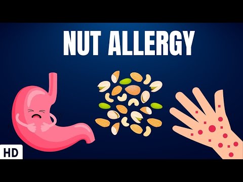 वीडियो: अखरोट एलर्जी की प्रतिक्रिया का इलाज करने के 4 तरीके