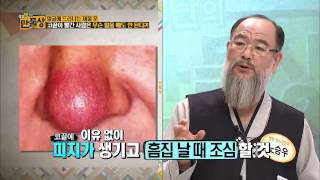 관상의 비밀 大공개 [살림9단의만물상] 92회 20150111