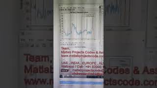Apnea Detection using Electrocardiography (ECG) - Sleep Apnea - ECG - Bioengineering - MATLAB