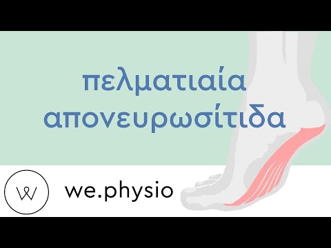 πελματιαία απονευρωσίτιδα (plantar fasciitis)