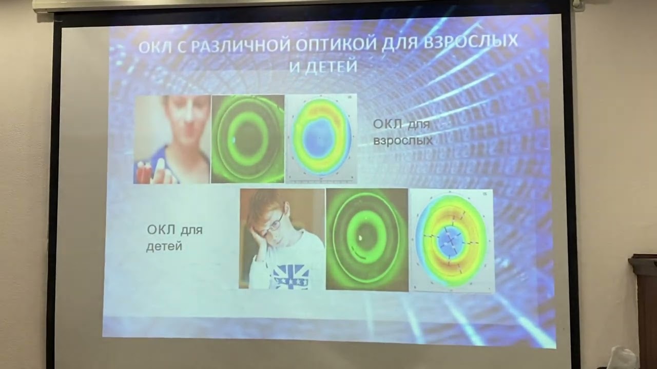 Видеоотчёт по 2-му заседанию ПКОО "Ассоциация врачей-офтальмологов" 04.03.2022. 