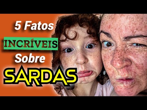 Vídeo: 3 maneiras de destacar sardas naturais