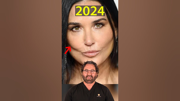 Demi Moore’s New Face (2024) | Plastic Surgeon Reacts