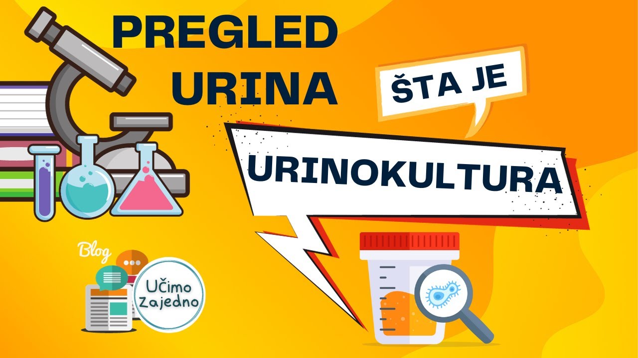 Laboratorijski pregled urina (šta je urinokultura?) YouTube